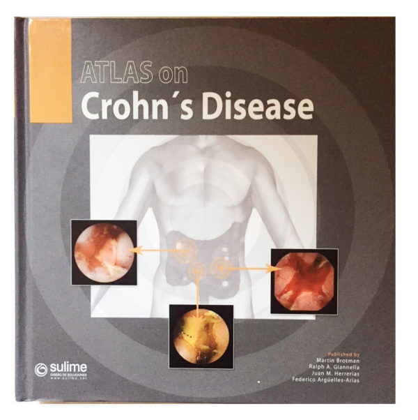 Atlas on Crohn's disease